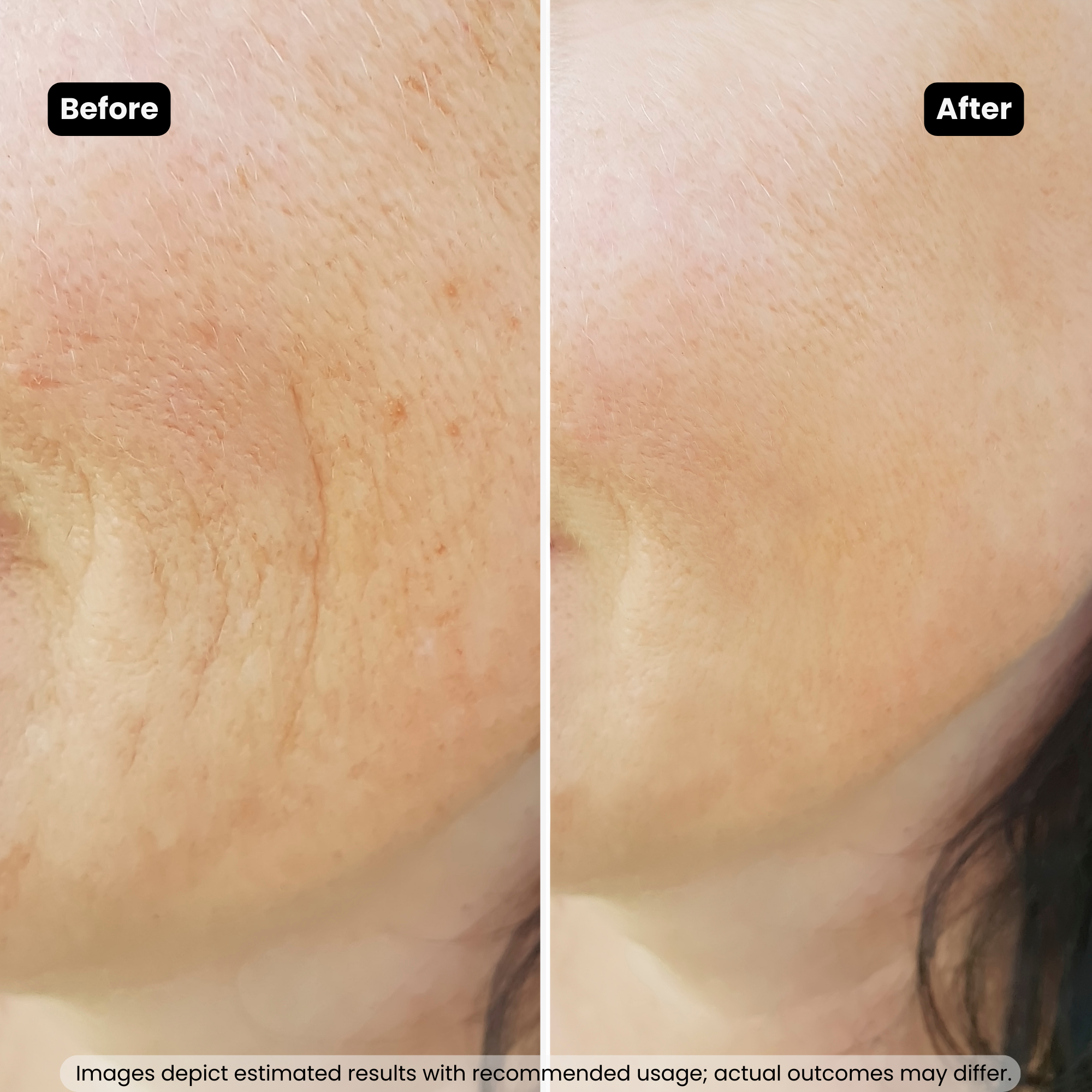 Bakuchiol 1% Face serum